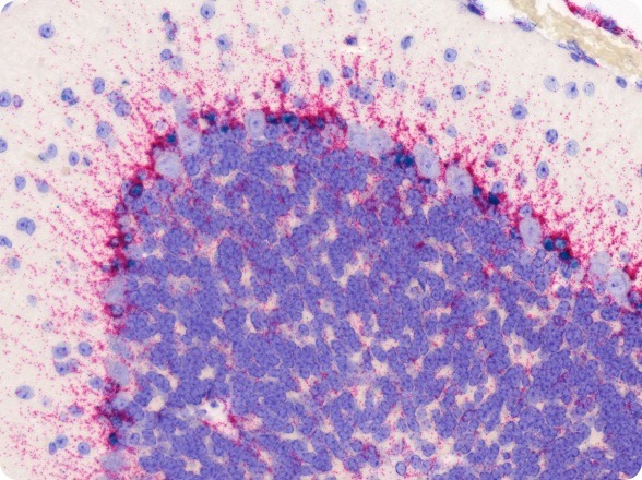 1401 ACDs RNAscope in situ hybridization technology gains significant traction