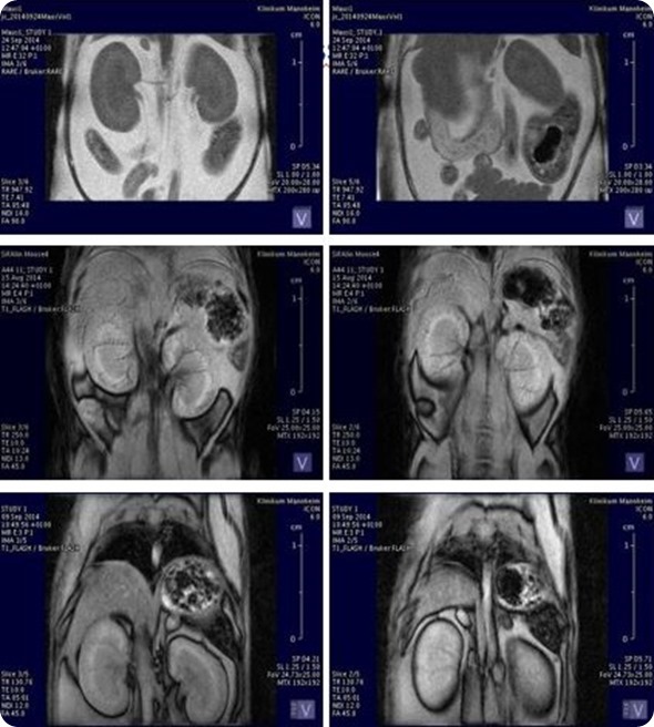 ICON: Organ volumetry and tissue characteristics