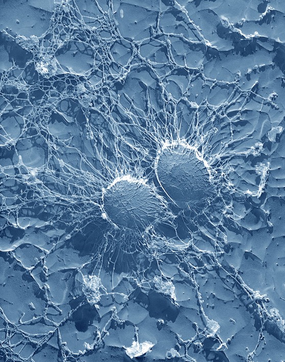 Staphylococcus aureus