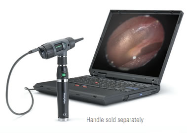 Welch Allyn Digital MacroView Otoscope
