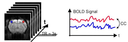 Principle of Seed based Functional Connectivity Analysis.