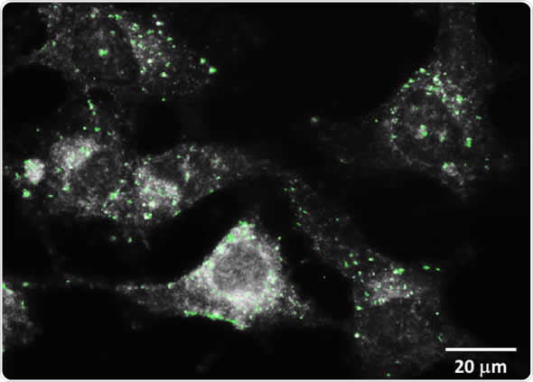 Monochromatic image at 550nm; GNPs marked in green after PCA.