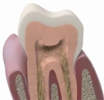 nanoXIM - The Enamel Repair Ingredient