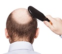 Natural sweetener improves hair loss treatment