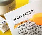 Lower dose of immunotherapy for malignant melanoma improves results