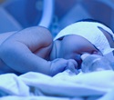Skin color may influence phototherapy effectiveness in newborns with jaundice