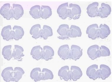 Brightfield scan of 16 Nissil stained rodent brains on a 2” x 3” slide at 0.5 μm