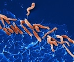 Scientists discover new receptors for stomach bacterium Helicobacter pylori