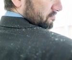 Newly completed genome sequence may provide new treatment options for dandruff