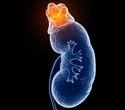 Stem cell treatment could help millions of people with end-stage kidney disease