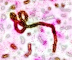 New technology may enable rapid diagnosis of Ebola virus