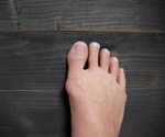 Causes of Foot Pain