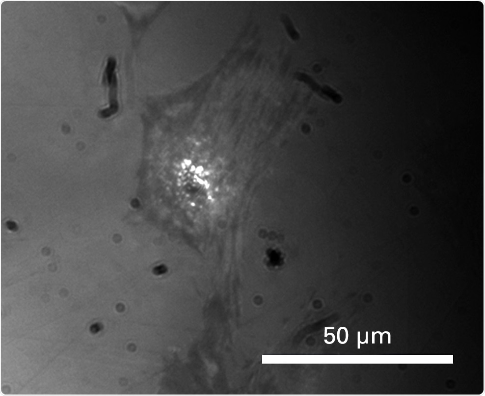 1 mm spherical probe in contact with osteoblast cell.
