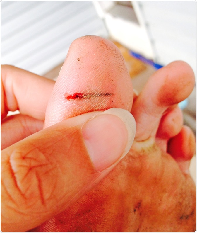 Splinter. Image Credit: Wendy van Overstreet / Shutterstock