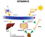 Rheumatoid Arthritis and Vitamin D