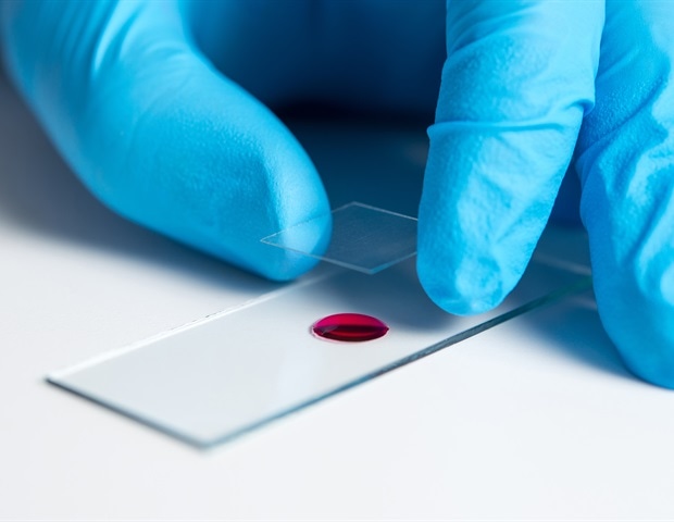 Study provides a new paradigm for managing transplant‑related immune complications