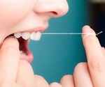 Regular dental flossing linked to lower risk of stroke and irregular heartbeats