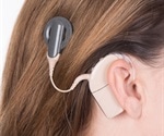 Cochlear implant restores hearing to patient with von Hippel-Lindau disease