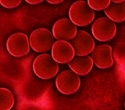 Gut microbial imbalance linked to chronic sickle cell disease pain