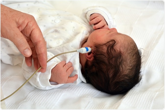 Newborn hearing screening. Image Credit: ChameleonsEye / Shutterstock
