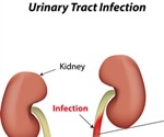 Urinary Tract Infections in Children