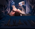 Cesarean Section Recovery