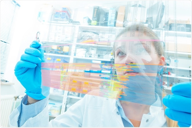 Image Credit: Science photo / Shutterstock