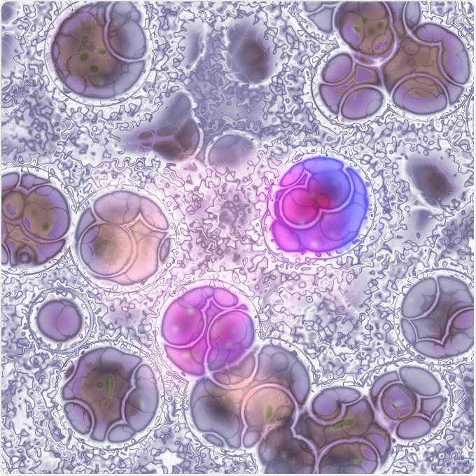 Leukemia cells