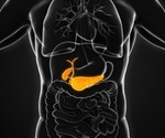 Causes of Bile Duct Cancer
