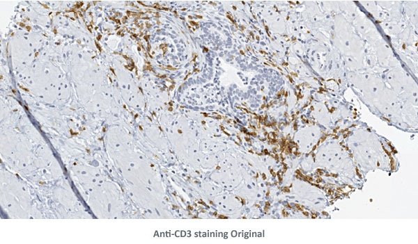 AntiCD3 Det Orig