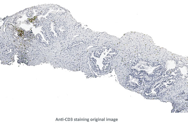 AntiCD3 Original