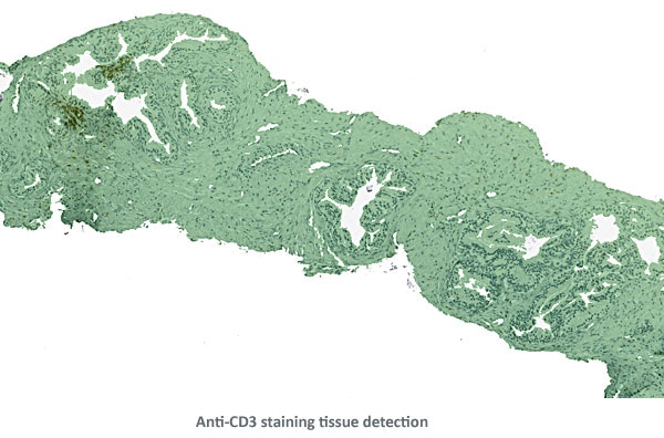 AntiCD3 TissueDetection