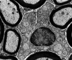 Limitations of TEM