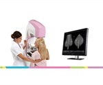 FDA issues approval letter for Planmed Clarity 2D digital mammography system