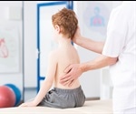 Study links poor manganese uptake to scoliosis