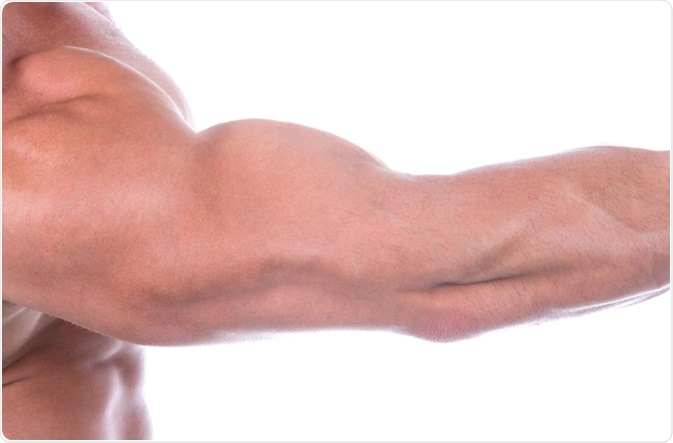 Image Credit: Aleksandar Todorovic / Shutterstock