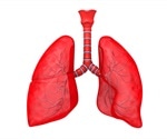 Pneumonia Diagnosis