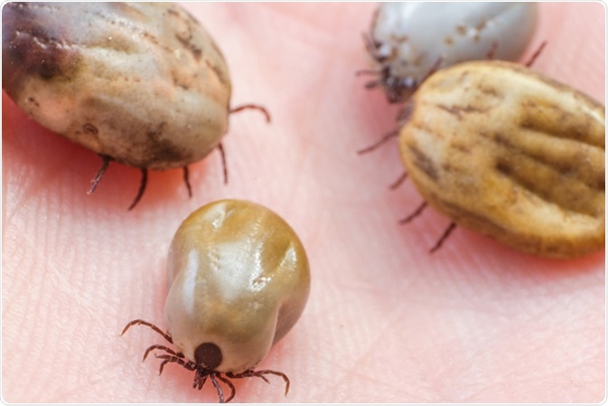 Tick filled with blood sitting on human skin. Image Credit: Afanasiev Andrii / Shutterstock