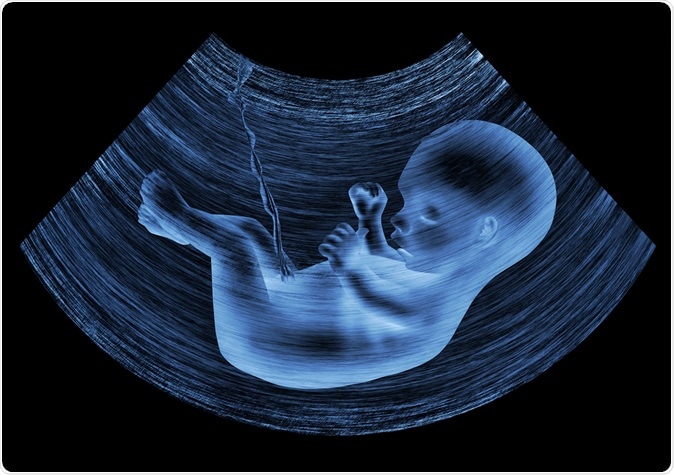 Ultrasound image of baby in mother