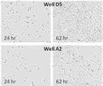 Monitoring and Quantification of Cell Growth using IncuCyte Automated Live-Cell Analysis System