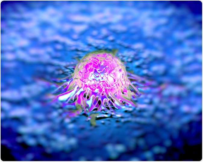 Prostate cancer cells, SEM, illustration. Image Credit: royaltystockphoto.com / Shutterstock