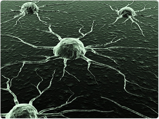 Cancer Cells. Image Credit: BioMedical / Shutterstock