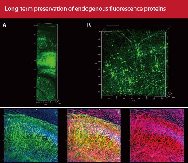 Thy1-YFP mouse brain slices cleared with the X-CLARITY™ systems and reagents. Thy1-YFP (green), Anti-Collagen IV (red), TO-PRO-3 (blue).