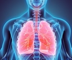 Phenotyping of Chronic Obstructive Pulmonary Disease (COPD)