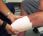 Toe transfer surgery outperforms replantation in hand function recovery