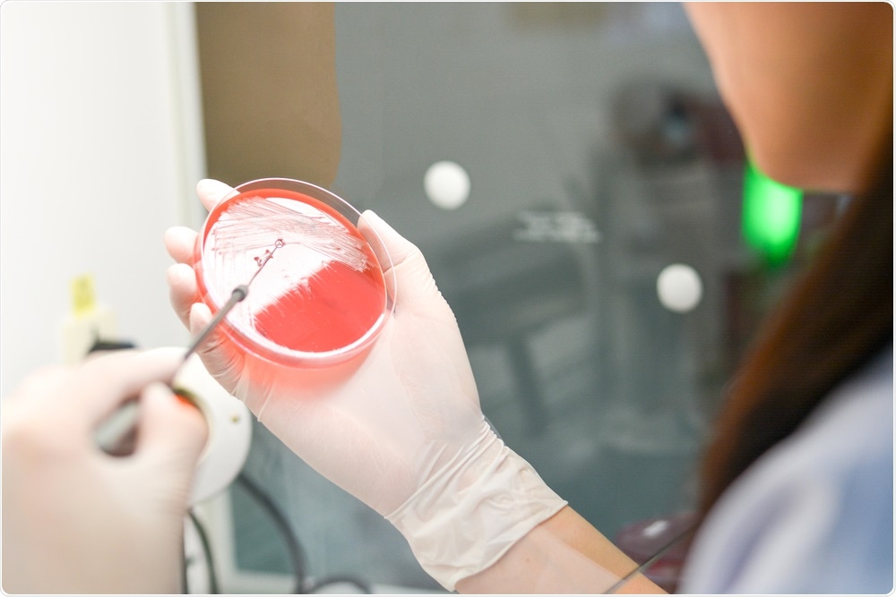 Microbial growth on agar plate showing causative agent of sepsis
