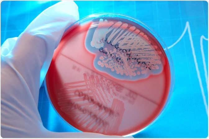 Petri plate with bacteria Staphylococcus Aureus, Moraxella Catarrhalis. Image Credit: Monika Wisniewska / Shutterstock