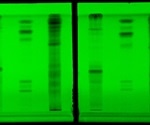 Thin Layer Chromatography