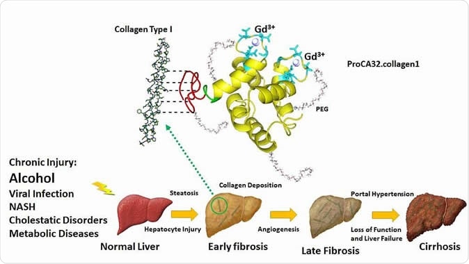 Novel collagen-targeted protein MRI contrast agent enables non-invasive detection of early stage of liver fibrosis by MRI. Jenny J. Yang, Ph.D., Georgia State University