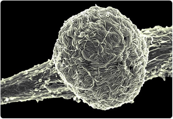 Ebola virus Makona covering the surface of an infected cell. Image Credit: NIAID